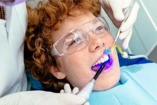 Fluoroza dentară: de ce apar petele pe dinți și ce soluții există