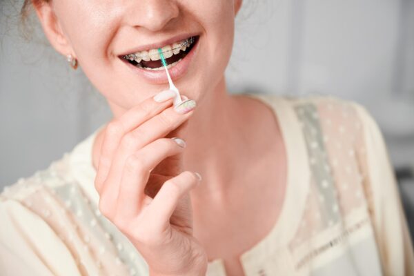 Periuța interdentară pentru aparat dentar: cum se folosește corect