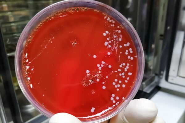 Bacterie găsită la un test: infecție sau colonizare?