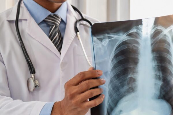 Cancer pulmonar: de ce tipul histologic și biomarkerii contează