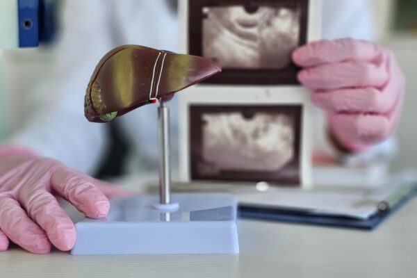 Elastografia hepatică: ce informații oferă despre ficat